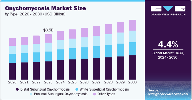 Global Onychomycosis Market size and growth rate, 2024 - 2030