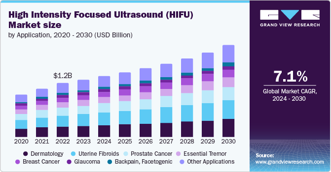 High Intensity Focused Ultrasound Market size and growth rate, 2024 - 2030