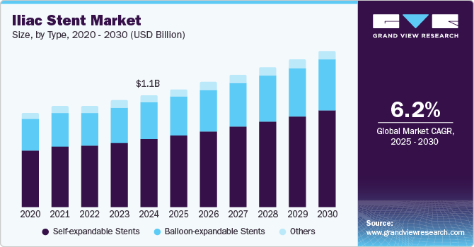 Iliac Stent Market size and growth rate, 2025 - 2030 Iliac Stent Market size and growth rate, 2025 - 2030