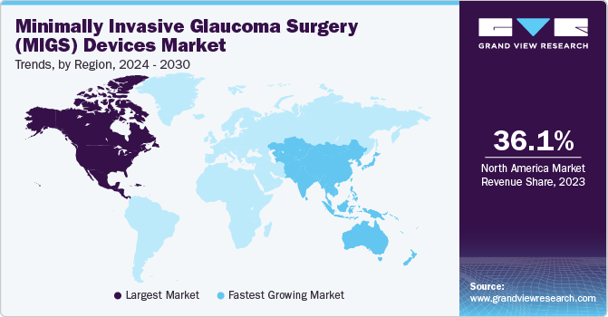 Minimally Invasive Glaucoma Surgery (MIGS) Devices Market Trends, by Region, 2024 - 2030