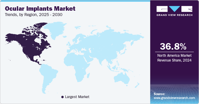 Ocular Implants Market Trends, by Region, 2025 - 2030