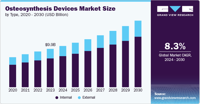 Osteosynthesis Devices Market Size by Type, 2020 – 2030 (USD Billion) 