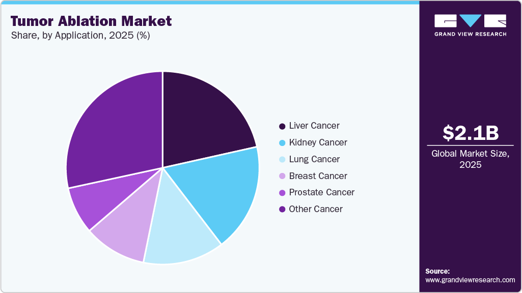 Tumor Ablation Market Share Tumor Ablation Market Share