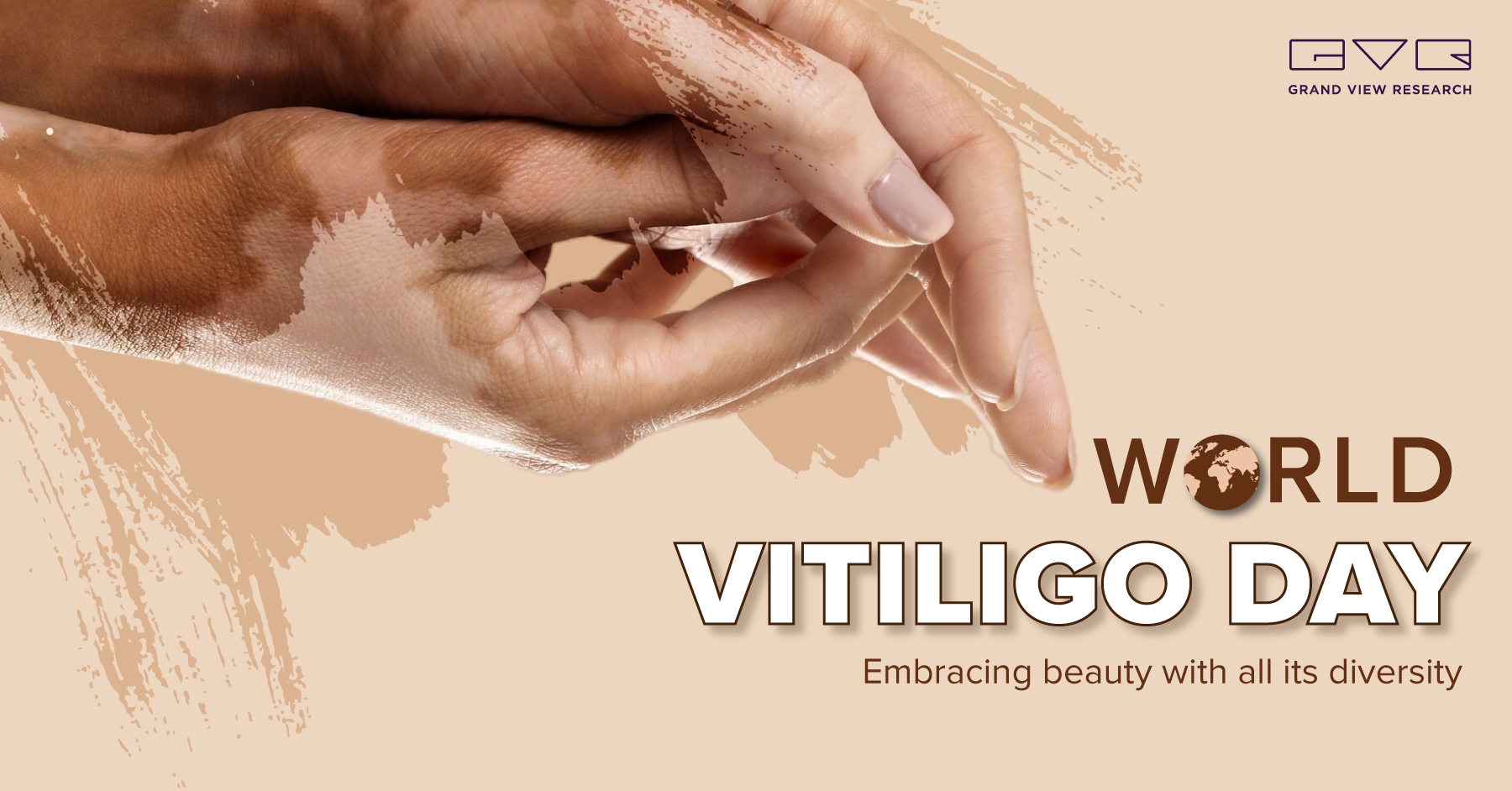 WORLD VITILIGO DAY